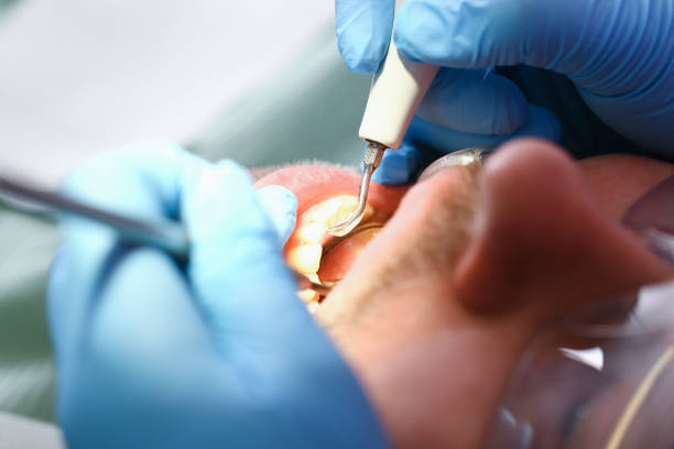 Best Emergency Dentist for Special Needs Patients in Horse Shoe, NC