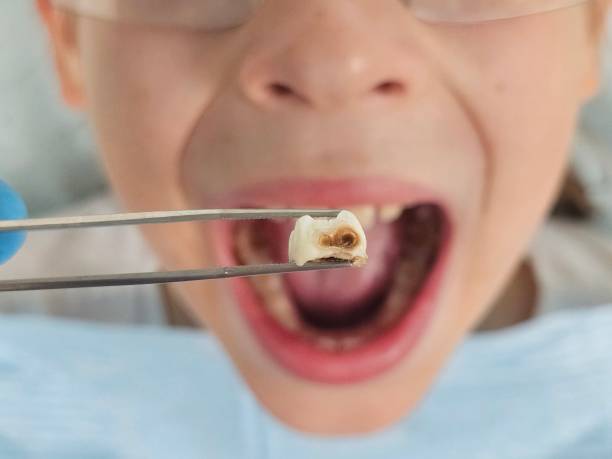 Best Holiday Emergency Dentist in Horse Shoe, NC