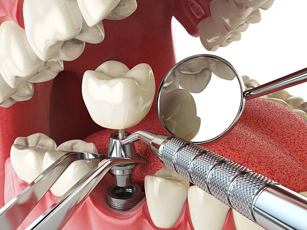 Best Orthodontic Emergency Dentist in Horse Shoe, NC